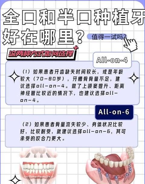 路由器WAN口与LAN口区别详解